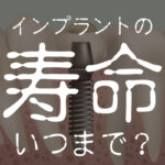 インプラントの寿命