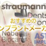 おすすめのインプラントメーカーを紹介：メーカーの選び方等も解説