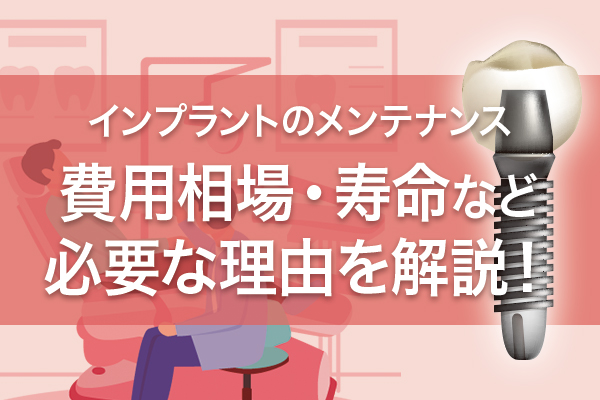 インプラントのメンテナンスの費用相場・寿命・必要な理由等を解説