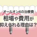 オールオン4 の治療費：相場や費用が抑えられる理由等を解説