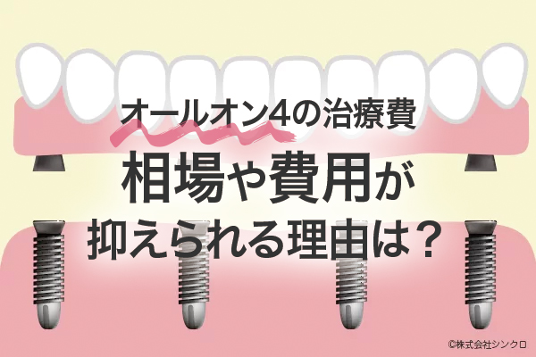 オールオン4 の治療費：相場や費用が抑えられる理由等を解説