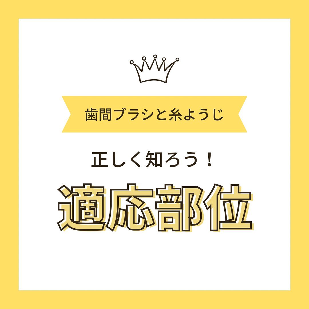 こんにちは高田馬場駅前店デンタルクリニックです！今回は歯間ブラシと糸ようじの種類と適応部位について投稿しました‍♀️ホームケアの参考にしてください！#高田馬場#高田馬場駅前デンタルクリニック#一般歯科#矯正歯科#口腔外科#審美歯科