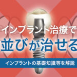 インプラント治療で歯並びが悪いのは治せる？インプラントの基礎知識等を解説