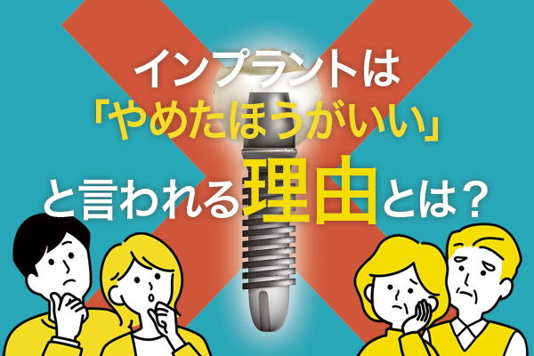 インプラントをやめたほうがいいと言われる理由とは？