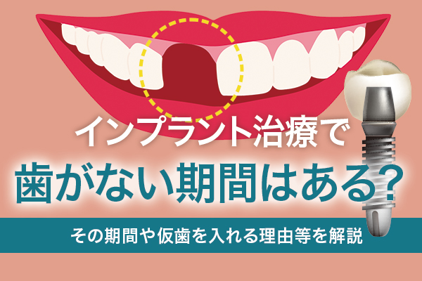 インプラント治療で歯がない期間はある？その期間や仮歯を入れる理由等を解説