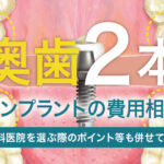 奥歯2本のインプラントの費用相場：歯科医院を選ぶ際のポイント等も併せて解説