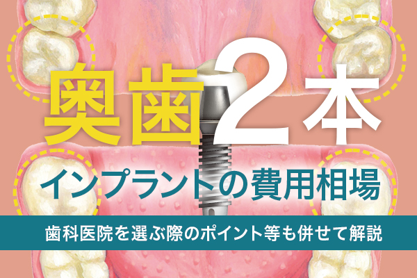 奥歯2本のインプラントの費用相場：歯科医院を選ぶ際のポイント等も併せて解説