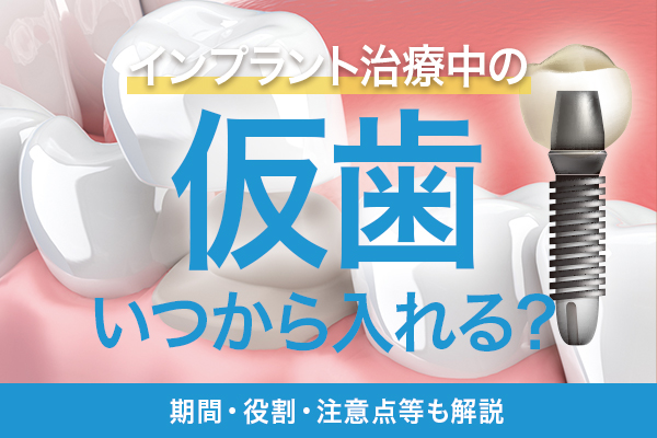 インプラント治療中の仮歯はいつから入れる？期間・役割・注意点等も解説