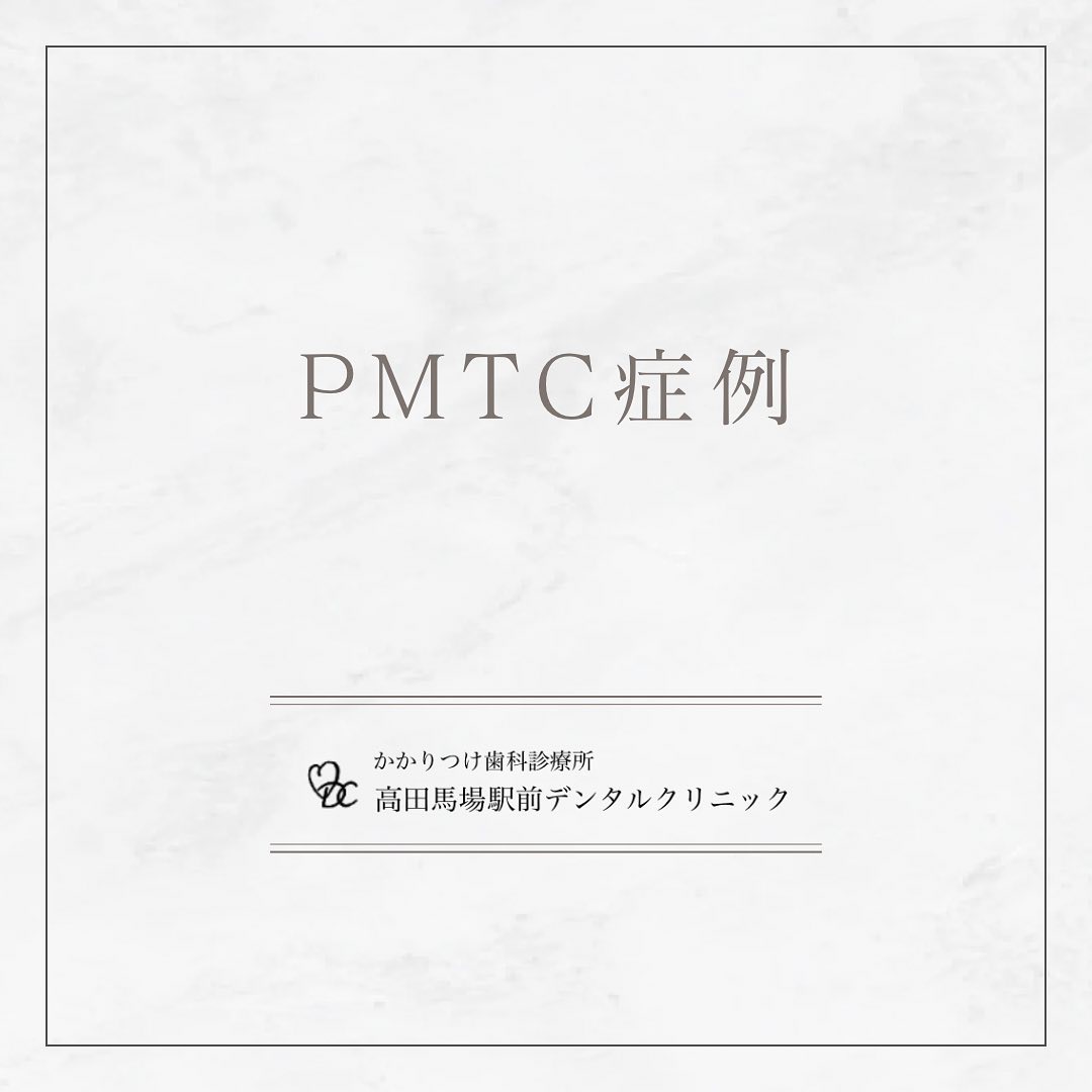 こんにちは！高田馬場駅前デンタルクリニックです🦷口内の健康は、心身の健康と密接に関連しています。PMTC（Professional Mechanical Tooth Cleaning）は、歯垢や歯石を丁寧に取り除き、口腔内を清潔に保つことで、虫歯や歯周病の予防につながります。春の訪れと共に、健やかな笑顔をお届けするために、ぜひPMTCをお試しください。お問い合わせやご予約はお気軽にどうぞ️高田馬場駅前デンタルクリニック〒169-0075東京都新宿区高田馬場2丁目16-2 1F03-6380-2467#高田馬場 #歯医者 #高田馬場歯医者 #インプラント #虫歯 #審美歯科 #デンタルクリニック #一般歯科 #矯正歯科 #口腔外科 #PMTC #ホワイトニング