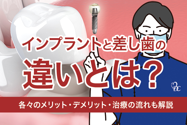 インプラントと差し歯の違いとは？各々のメリット・デメリット・治療の流れも解説