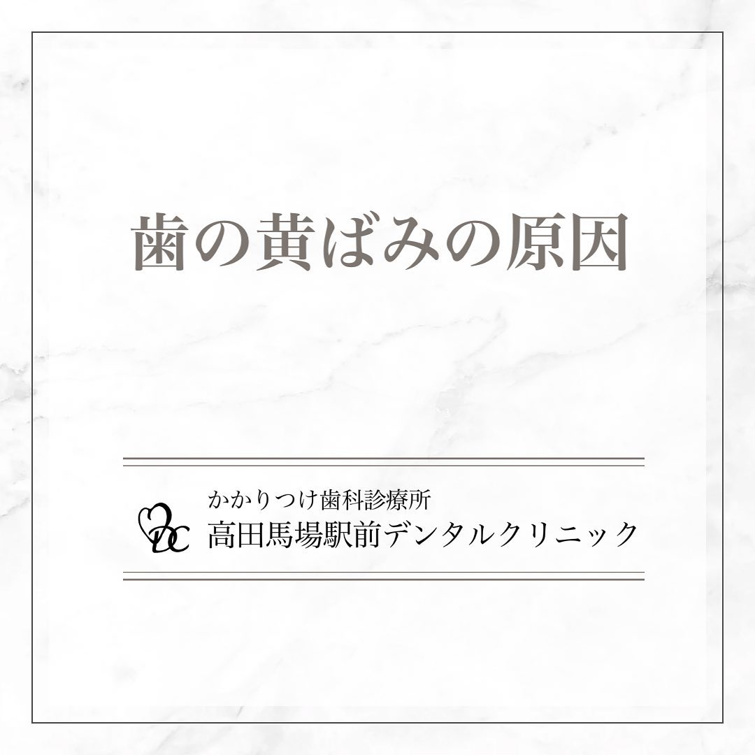 こんにちは！高田馬場駅前デンタルクリニックです。 歯の黄ばみの原因 気になる歯の黄ばみ、その原因を知っていますか？1️⃣ 飲食物・タバコ: コーヒー、紅茶、ワイン、タバコなどが歯を着色します。2️⃣ 歯の磨き残し: 日々の歯磨きで取り切れない汚れが蓄積します。3️⃣ 加齢: 年齢とともにエナメル質が薄くなり、内側の象牙質が見えるようになります。4️⃣ 薬・怪我: 一部の薬や外傷が歯の色に影響を与えます。5️⃣ 生まれつき: 遺伝的な要因で歯の色が異なることがあります。原因を知って、白い歯を目指しましょう！🦷 お問い合わせやご予約はお気軽にどうぞ️高田馬場駅前デンタルクリニック〒169-0075東京都新宿区高田馬場2丁目16-2 1F03-6380-2467#高田馬場 #歯医者 #高田馬場歯医者 #インプラント #虫歯 #審美歯科 #デンタルクリニック #一般歯科 #矯正歯科 #口腔外科 #PMTC #黄ばみ