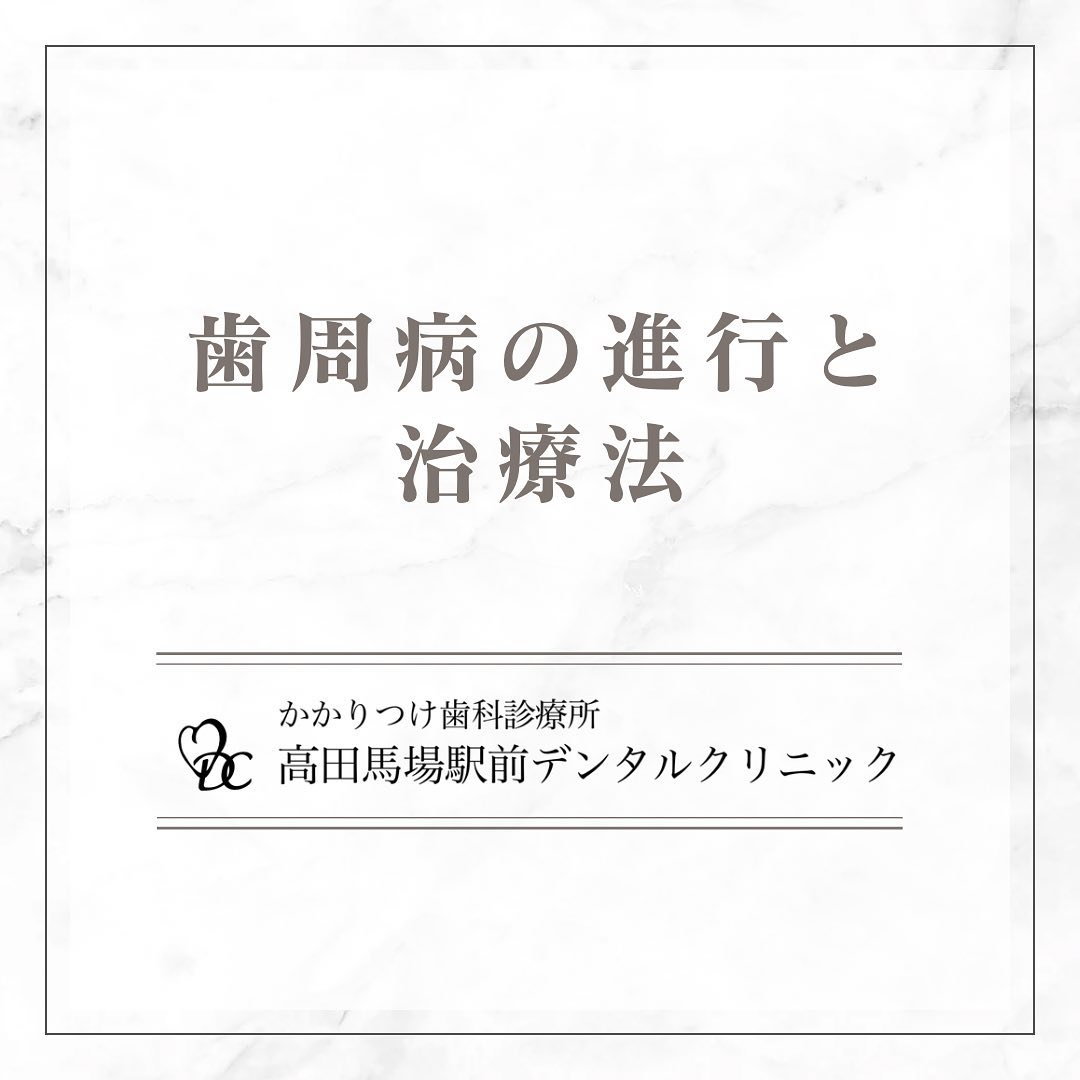 こんにちは！高田馬場駅前デンタルクリニックです。 歯周病の進行と治療法 歯周病の進行段階と治療法をご紹介します！🦷 軽度歯周病: 歯ぐきが赤く腫れ、歯磨き時に出血することがあります。早期治療が重要です。この段階では、1～2回のクリーニングや適切なブラッシング指導で改善が期待できます。🔄 中度歯周病: 歯ぐきの腫れがひどくなり、口臭も強くなります。歯ぐきのポケットが深くなり、歯がぐらつくことも。この段階では、歯石の除去が必要です。 重度歯周病: 歯ぐきの炎症が進行し、歯を支える骨が溶けてしまいます。歯が抜け落ちる危険性もあります。外科的治療が必要です。歯周病は早期発見と治療が大切です。定期的な歯科検診で健康な口内環境を保ちましょう！🦷お問い合わせやご予約はお気軽にどうぞ️高田馬場駅前デンタルクリニック〒169-0075東京都新宿区高田馬場2丁目16-2 1F03-6380-2467#高田馬場 #歯医者 #高田馬場歯医者 #インプラント #虫歯 #審美歯科 #デンタルクリニック #一般歯科 #矯正歯科 #口腔外科 #歯周病